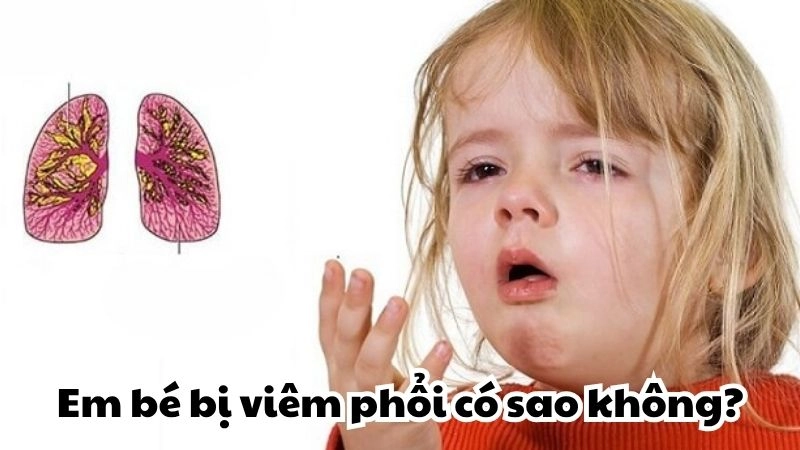 Em bé bị viêm phổi có sao không và cách nhận biết sớm
