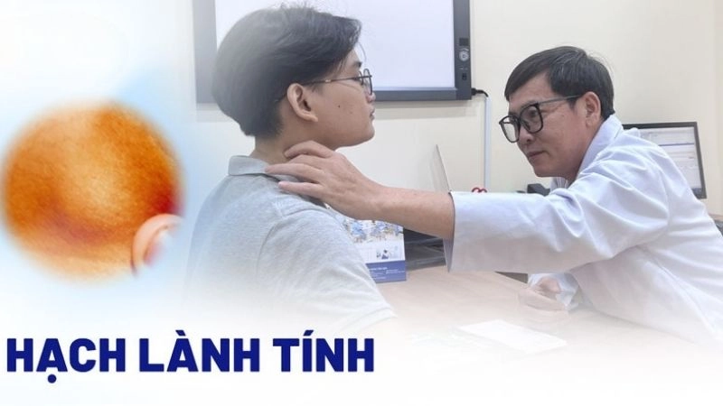 Hạch lành tính là hạch sưng do viêm nhiễm, dị ứng, hoặc do một số bệnh lý 