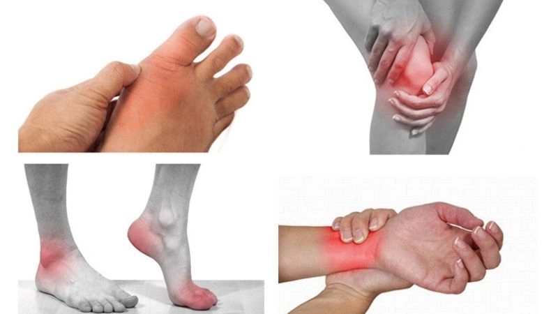 phong thấp (hay phong tê thấp) chỉ là tên gọi của Đông y