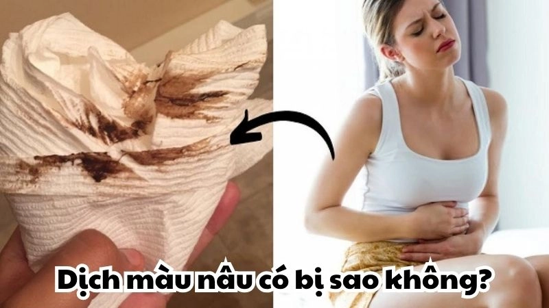 Dịch màu nâu có bị sao không và cách xử lý tại nhà