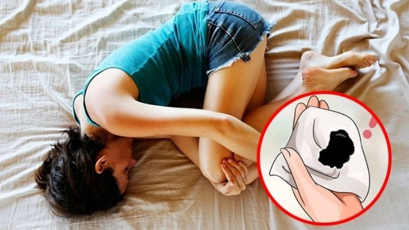 Màu sắc của máu kinh phản ánh tình trạng sức khỏe của người phụ nữ