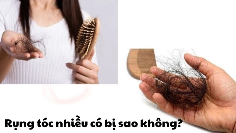Rụng tóc nhiều có bị sao không và cách xử lý kịp thời