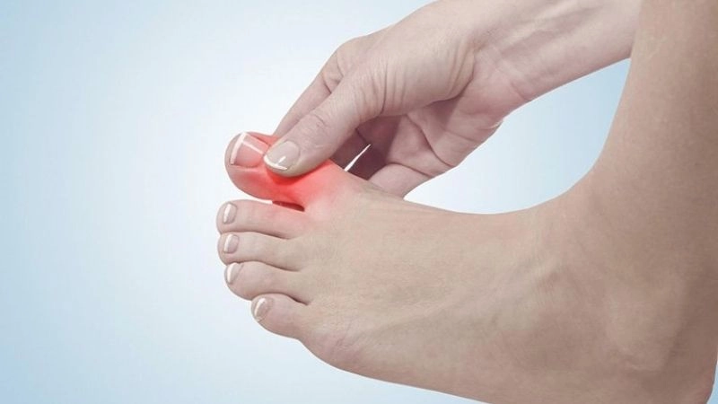 Khi bị gút, người bệnh không chỉ đau mà còn hoang mang vì không biết phải làm sao