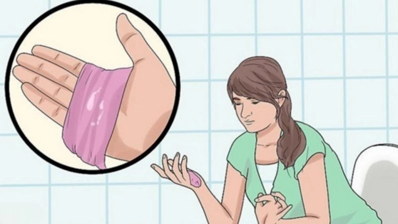 Huyết trắng bệnh lý nếu không được khắc phục kịp thời có thể gây ra những ảnh hưởng xấu