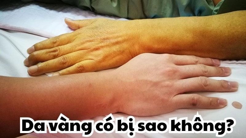 Da vàng có bị sao không - Dấu hiệu nguy hiểm cần biết ngay