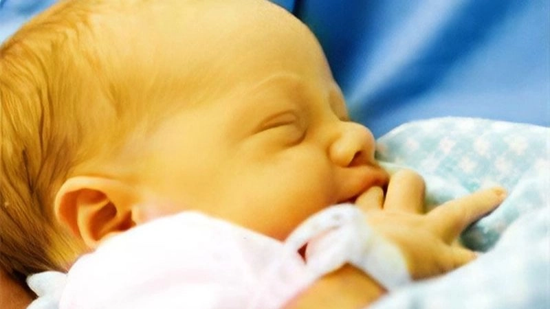Vàng da (Jaundice) là tình trạng xảy ra khi cơ thể không chuyển hoá và đào thải được bilirubin