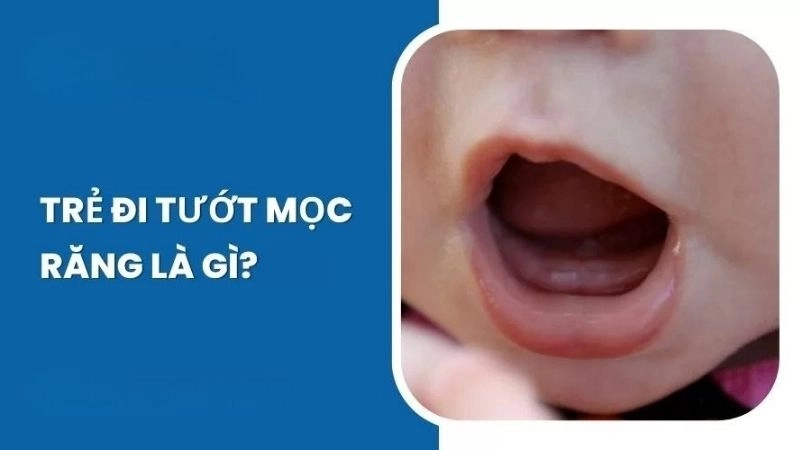 Đi tướt thực chất không khác gì nhiều so với hiện tượng tiêu chảy