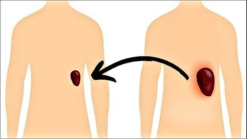 Lá lách là cơ quan nằm bên dưới lồng xương sườn phía trên bên trái của bụng