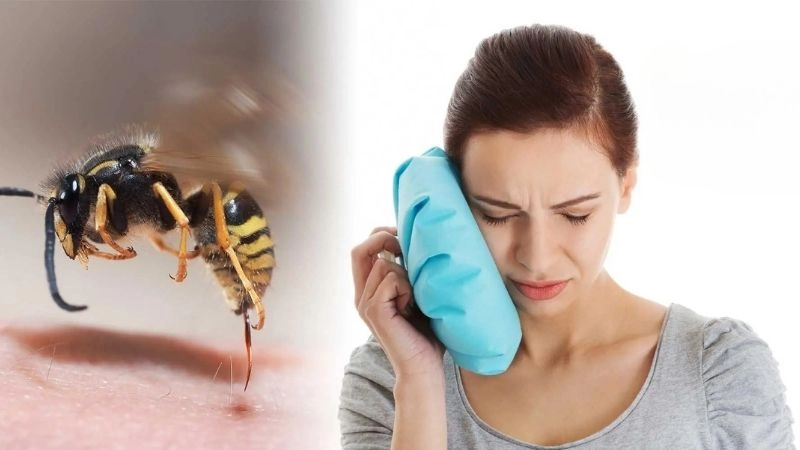 Cách xử lý khi bị ong đốt cần lưu ý