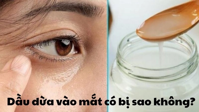 Dầu dừa vào mắt có bị sao không và cách xử lý đúng
