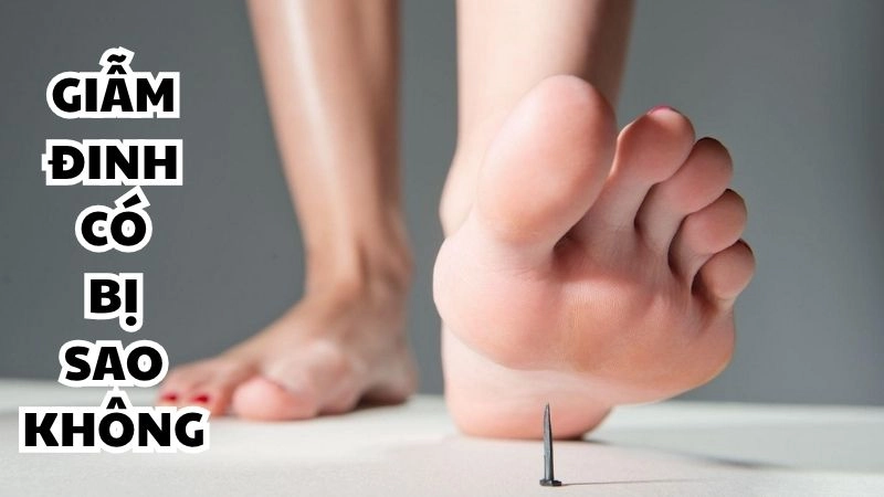 Giẫm đinh có bị sao không và cách xử khẩn cấp kịp thời
