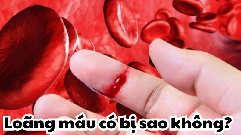 Loãng máu có bị sao không và phương pháp điều trị an toàn
