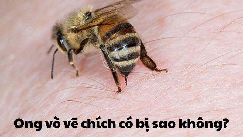 Ong vò vẽ chích có bị sao không - Cách xử lý hiệu quả