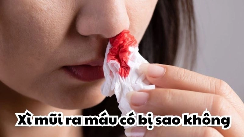 Xì mũi ra máu có bị sao không và nguy hiểm thế nào