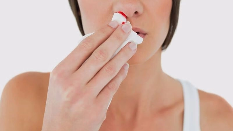 Xỉ mũi ra máu là tình trạng khi có một lượng máu nhỏ lẫn trong dịch nhầy mũi