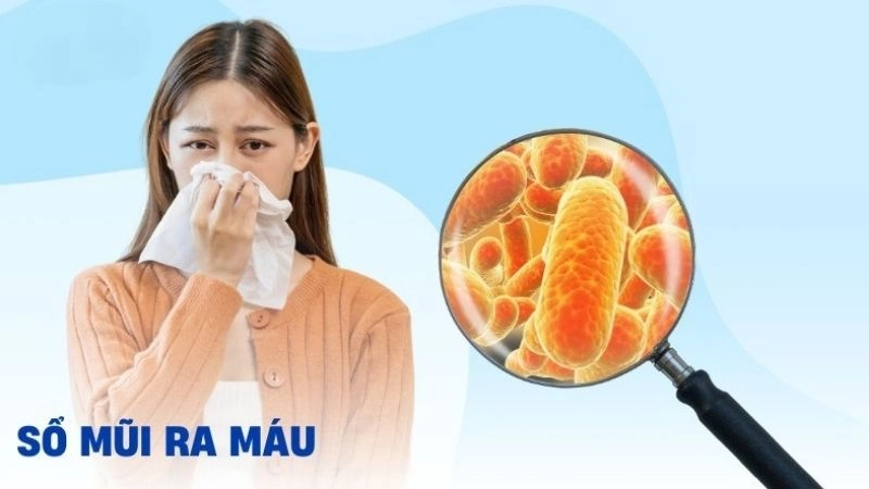 Nguyên nhân dẫn đến xì mũi ra máu