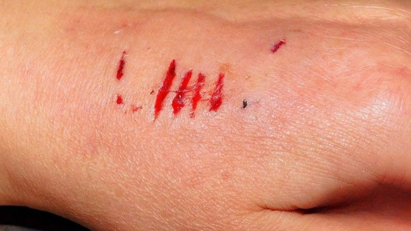 Bị thỏ cắn có sao không là câu hỏi được nhiều người thắc mắc