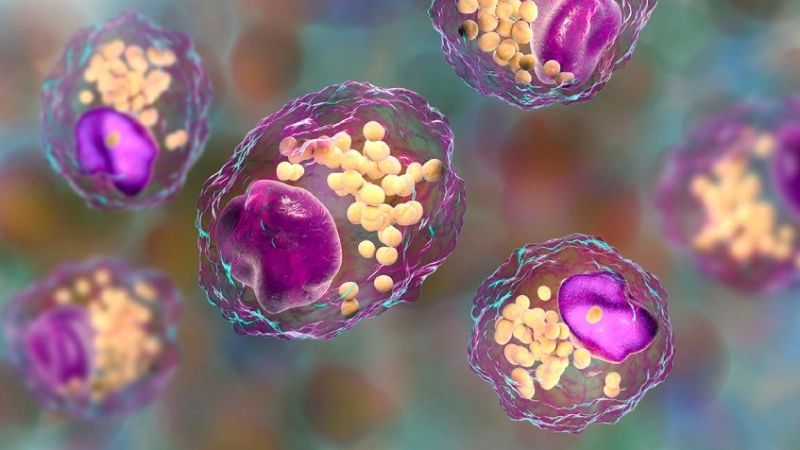 Nguyên nhân và hậu quả của tình trạng triglyceride cao là gì?