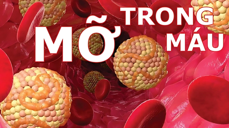 Định lượng triglyceride là gì và làm sao để kiểm soát chỉ số này?