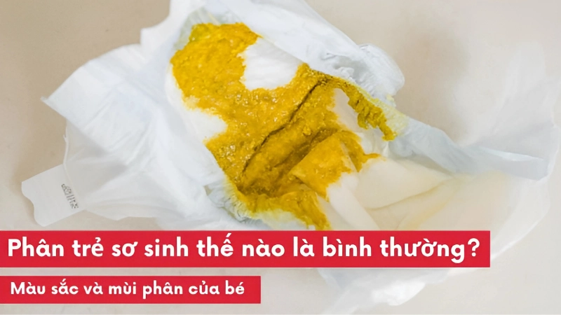 Đặc điểm phân trẻ sơ sinh bình thường