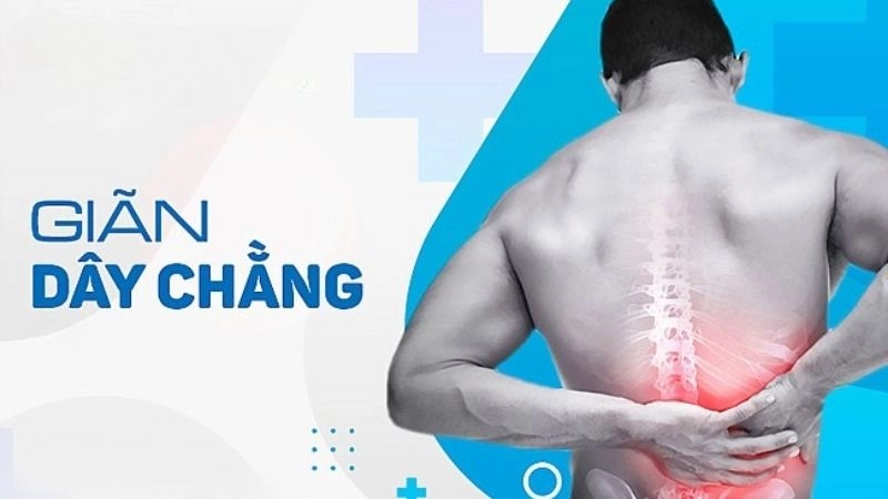 Giãn dây chằng và các mẹo chữa trị hiệu quả từ dân gian