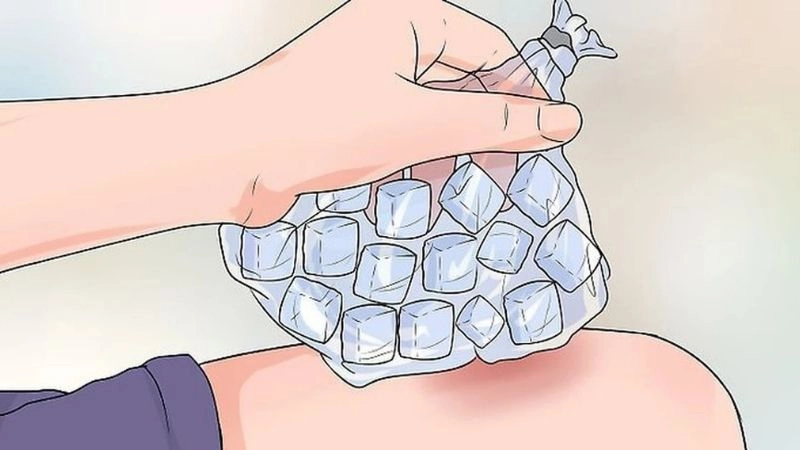 Mẹo chữa giãn dây chằng hiệu quả tại nhà