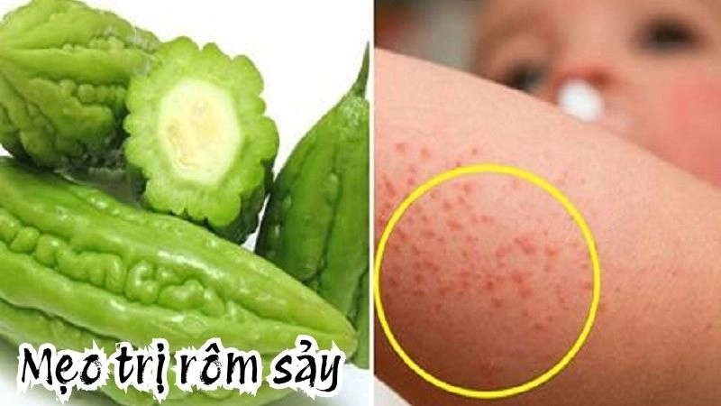 Trị rôm sảy không cần thuốc nhờ mẹo dân gian cổ truyền