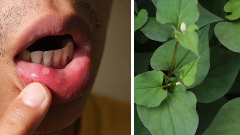 Mẹo dân gian trị nhiệt miệng với lá cây dễ tìm