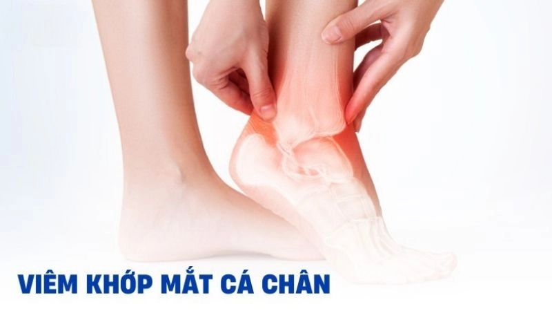 Tác hại của bàn chân bẹt âm thầm phát triển
