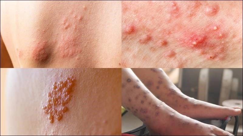 Tác hại của bệnh tiểu đường khó đoán trước được