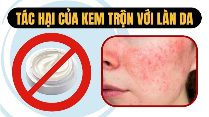 Sốc với tác hại dùng kem trộn âm thầm hủy hoại làn da