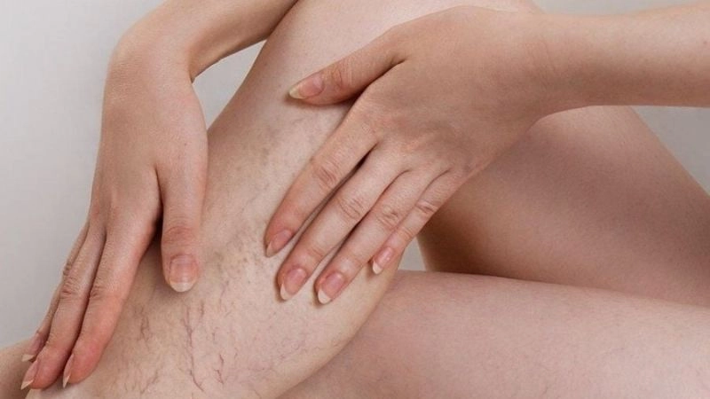 Tác hại của kem trộn làm da bào mòn nghiêm trọng