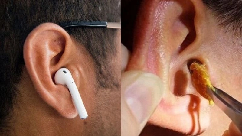 Đeo tai nghe nhiều khiến tai bị viêm nhiễm