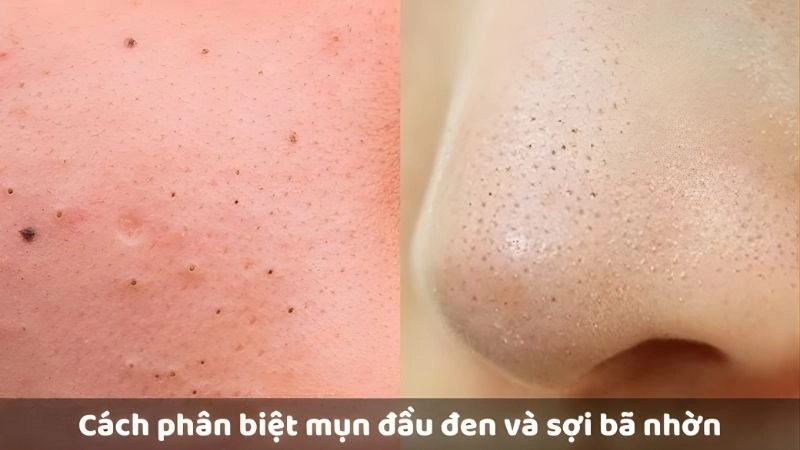 Cách nhận diện nhanh chóng bằng mắt thường