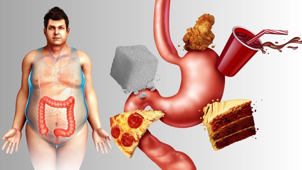 Tác hại của đồ chế biến sẵn chứa muối gây áp lực lên thận