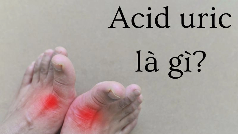 Acid uric là gì? Dấu hiệu ban đêm bạn không ngờ tới sớm
