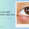 Mẹo Chữa Mụt Lẹo Mắt Hiệu Quả Nhanh Chóng Tại Nhà Năm 2026