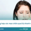Mẹo chữa quai bị nhanh nhất tại nhà, giảm sưng đau hiệu quả 2026