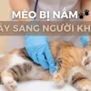 Nấm mèo ở người: Nguyên nhân, triệu chứng và cách điều trị an toàn