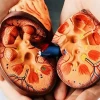 Phân biệt nước tiểu đầu và nước tiểu chính thức: Hiểu rõ sự khác biệt