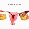 Phân biệt rõ máu báo thai và máu kinh: Dấu hiệu nào cần lưu tâm?