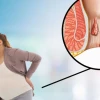 Phân biệt trĩ nội và trĩ ngoại: Dấu hiệu nhận biết và cách điều trị