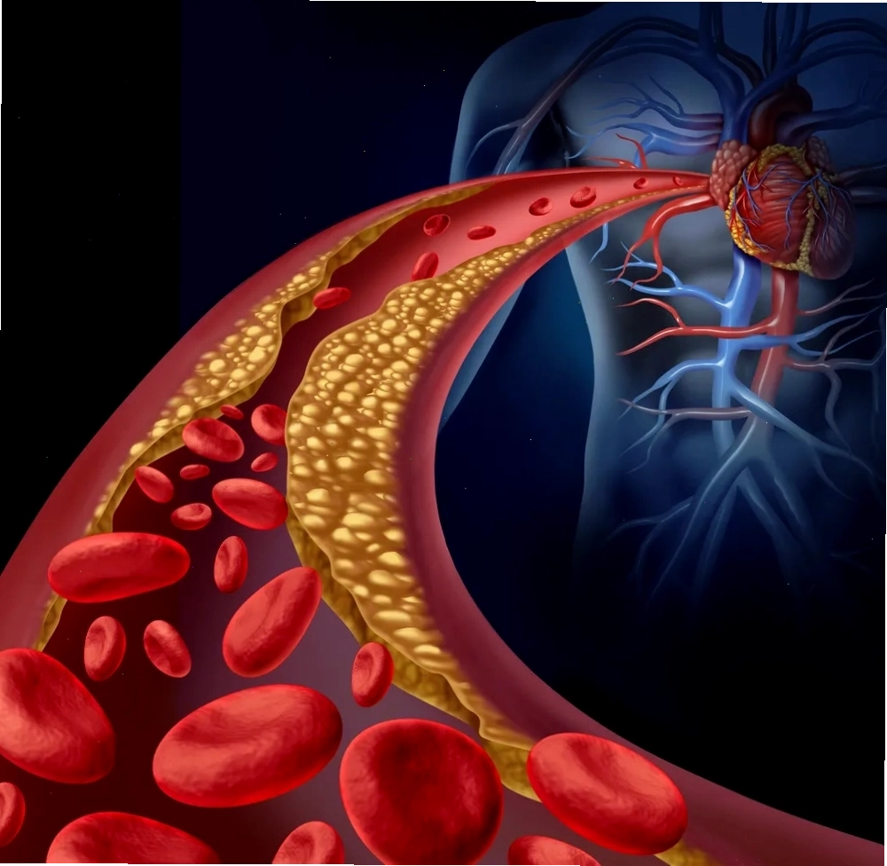 Ảnh minh họa về chỉ số cholesterol