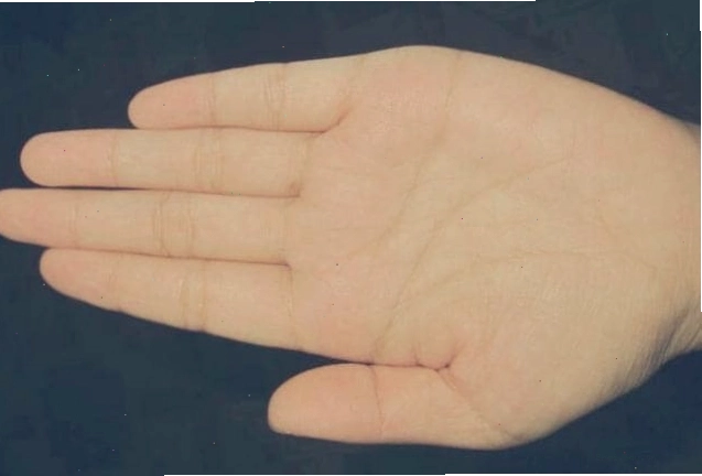 Bàn tay nam giới với dấu hiệu hình chữ M trên đường vận mệnh.