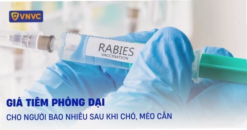 Bảng giá tiêm phòng dại tại các trung tâm y tế