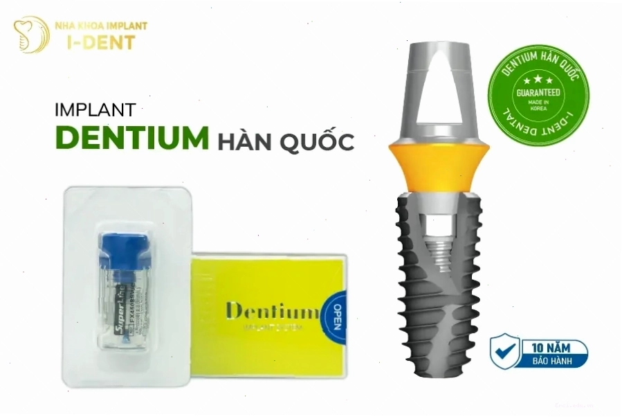 Bảng so sánh các trụ implant phổ biến trên thị trường