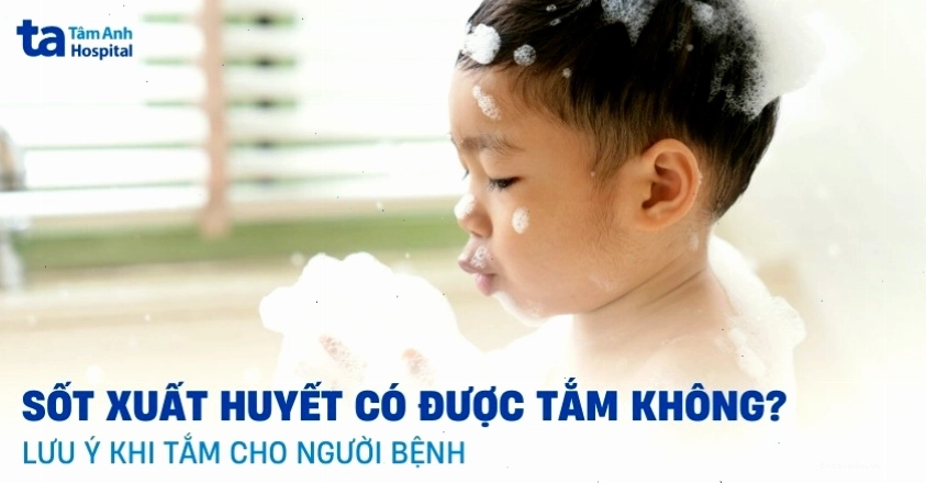 Bị sốt xuất huyết có được tắm không? Lưu ý khi tắm cho người bệnh