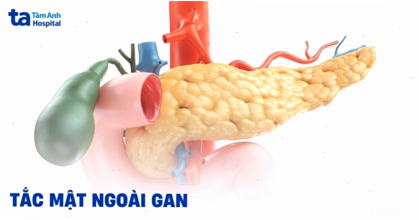 Biến chứng có thể xảy ra nếu ghẻ xốn không được điều trị