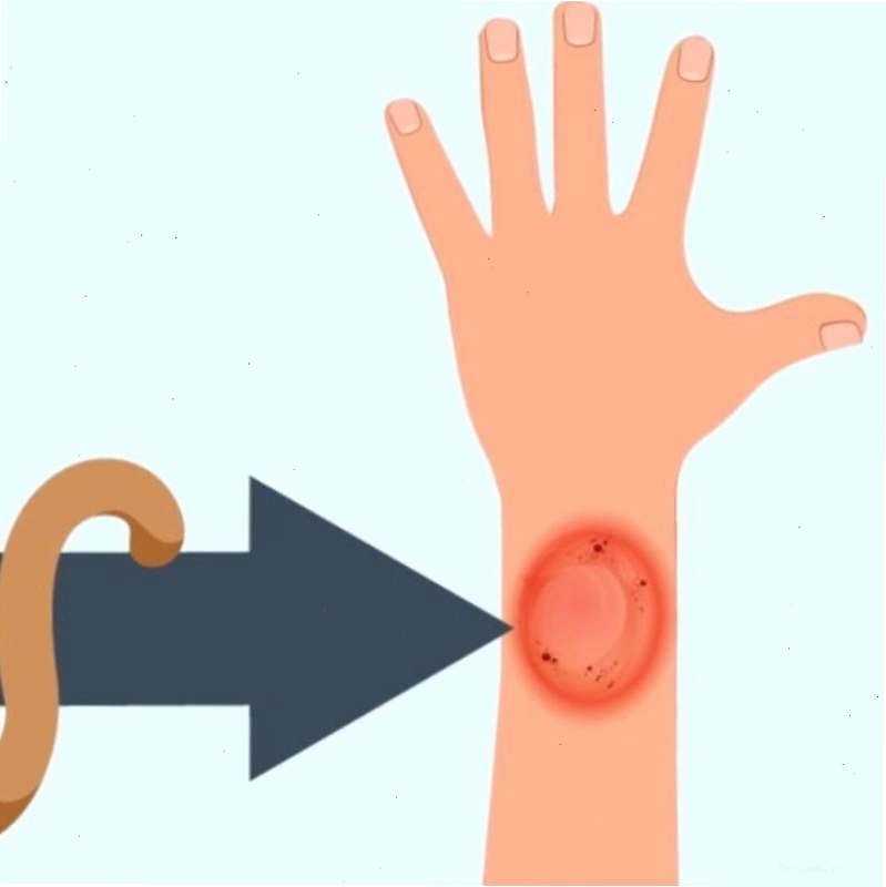Biện pháp vệ sinh và chăm sóc tại nhà giúp hỗ trợ điều trị nấm mèo ở người