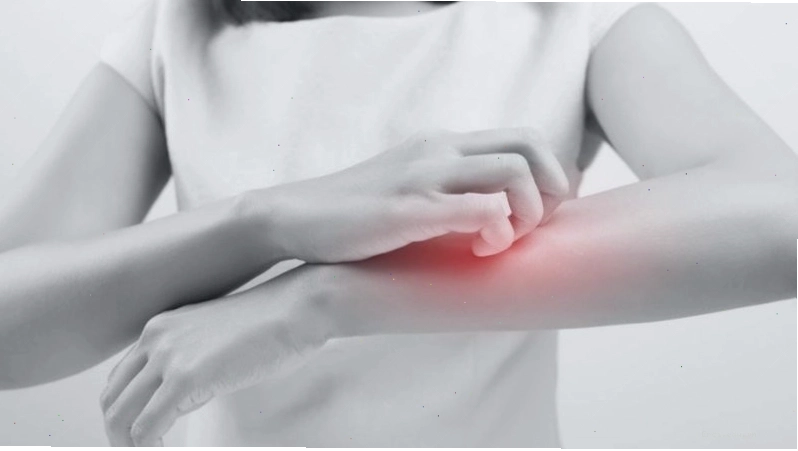 Các dấu hiệu cần gặp bác sĩ khi bị viêm da thần kinh